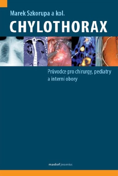 Chylothorax - Průvodce pro chirurgy, pediatry a interní obory - Marek Szkorupa