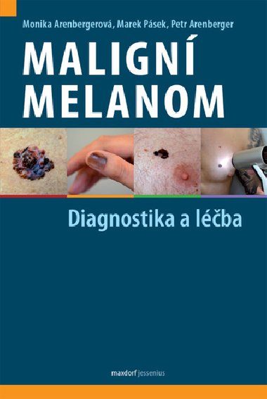Maligní melanom - Diagnostika a léčba - Monika Arenbergerová; Marek Pásek; Petr Arenberger
