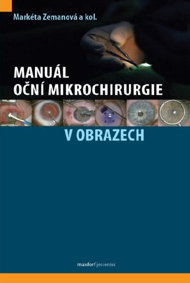 Manuál oční mikrochirurgie v obrazech - Markéta Zemanová