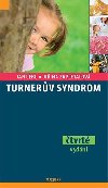 Turnerv syndrom - Jan Lebl; Jiina Zapletalov