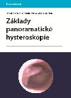 Zklady panoramatick hysteroskopie - David Kuel; Duan Tth; Michal Mra