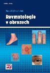 Revmatologie v obrazech - Marta Olejrov