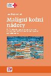 Malign kon ndory - Ivana Krajsov