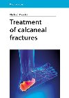 Treatment of Calcaneal Fractures - Vladimr Popelka