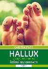 Hallux - Řešení bez operace - Carsten Stark