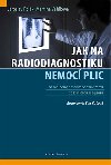 Jak na radiodiagnostiku nemoc plic - Jaroslav Polk; Martina Vakov