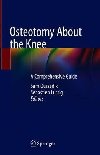 Osteotomy About the Knee : A Comprehensive Guide - Oussedik Sam