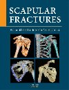 Scapular fractures - Jan Bartonek; Christopher Colton; Michal Tuek