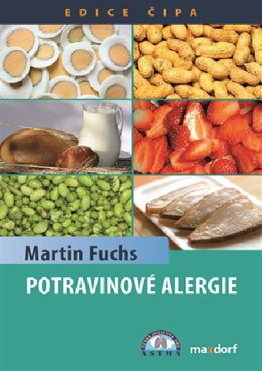 Potravinov alergie - Martin Fuchs
