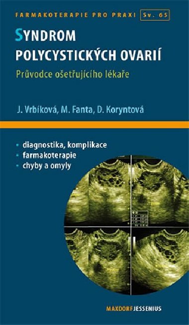 Syndrom polycystickch ovari - Jana Vrbkov; Michael Fanta; Dana Koryntov