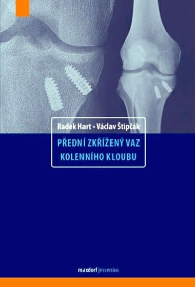 Pedn zken vaz kolennho kloubu - Hart Radek, tipk Vclav