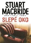 Slep oko - Stuart MacBride
