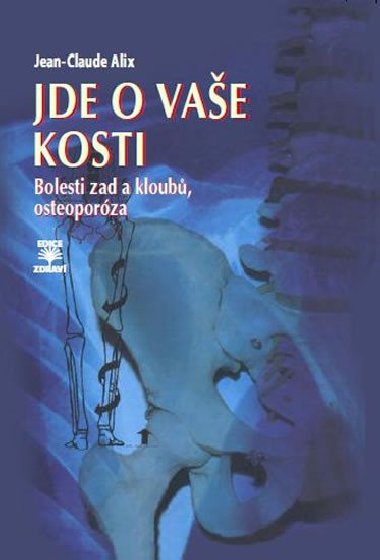 Jde o vae kosti - Bolesti zad a kloub, osteoporza - Alix Jean-Claude