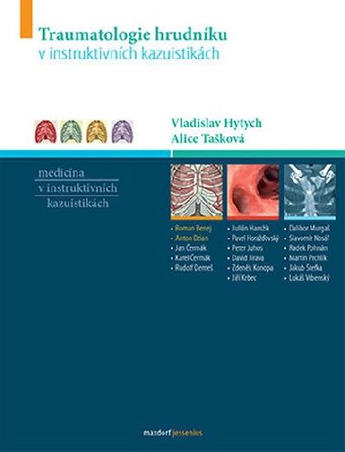 Traumatologie hrudnku v instruktivnch kazuistikch - Vladislav Hytych; Alice Takov