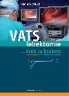 VATS lobektomie krok za krokem - Vladislav Hytych