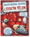Martinova cesta lidskm tlem - Svojtka