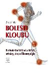 Bolesti kloub - Bezbolestn len artritidy, artrzy, dny a a fibromyalgie - Bruce Fife