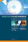 Praktick plicn chirurgie - Alice Takov; Vladislav Hytych