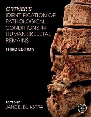 Ortner`s Identification of Pathological Conditions in Human Skeletal Remains - Buikstr Jane E.