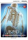 Bones: And the Stories They Tell Low Intermediate (Book with Online Access) - Naughton Diane