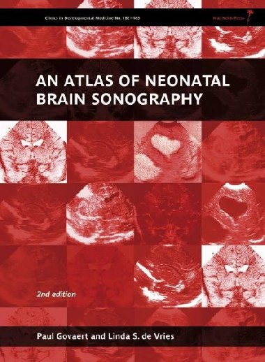 An Atlas of Neonatal Brain Sonography - Govaert Paul