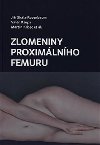 Zlomeniny proximlnho femuru - Ji Skla-Rosenbaum; Valr Dupa; Martin Krbec