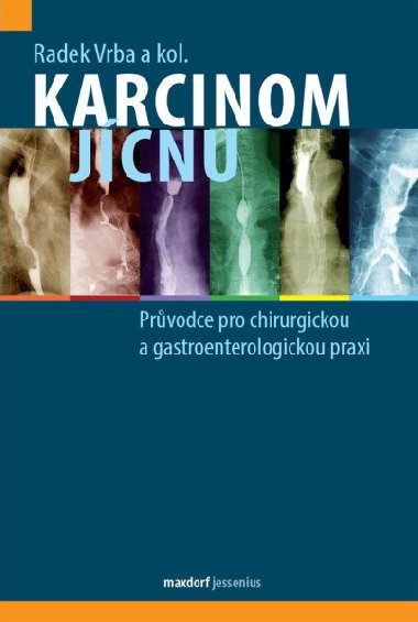 Karcinom jcnu - Prvodce pro chirurgickou a gastroenterologickou praxi - Radek Vrba