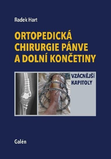 Ortopedick chirurgie pnve a doln konetiny - Vzcnj kapitoly - Radek Hart
