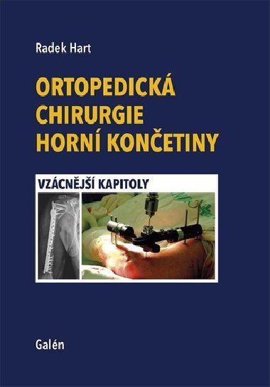 Ortopedick chirurgie horn konetiny - Radek Hart