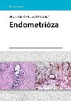 Endometriza - Lenz Ji; Chvtal Radek; Ludk Fiala
