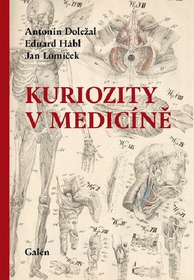 Kuriozity v medicn - Antonn Doleal; Eduard Hbl; Jan Lomek