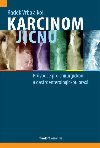 Karcinom jcnu - Prvodce pro chirurgickou a gastroenterologickou praxi - Radek Vrba
