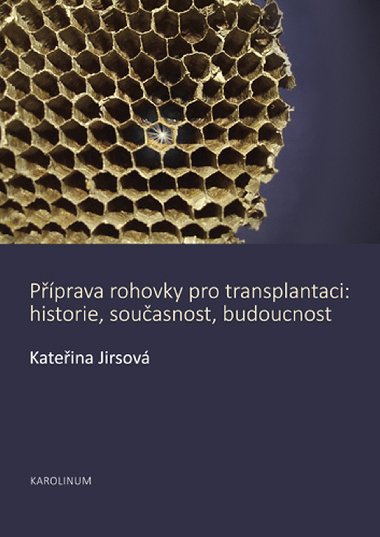 Pprava rohovky pro transplantaci - Kateina Jirsov 