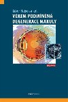 Vkem podmnn degenerace makuly - Libor Hejsek