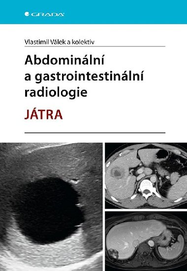 Abdominální a gastrointestinální radiologie - Vlastimil Válek , Vlastimil Válek kolektiv a 
