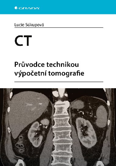 CT - Prvodce technikou vpoetn tomografie - Lucie Skupov 