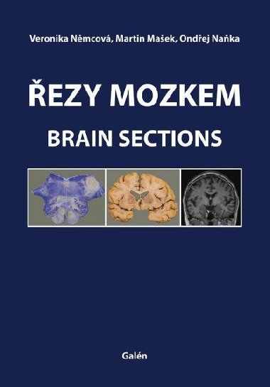 ezy mozkem / Brain Sections - Veronika Nmcov; Martin Maek; Ondej Naka