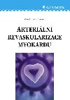 Arteriln revaskularizace myokardu - Marek Gwozdziewicz 