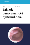 Zklady panoramatick hysteroskopie - Michal Mra , Michal Mra David Kuel , Michal Mra David Kuel kolektiv a , Michal Mra David Kuel kolektiv a Duan Tth 