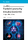 Funkn poruchy kloub konetin - Eva Rychlkov 