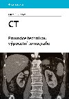 CT - Prvodce technikou vpoetn tomografie - Lucie Skupov 